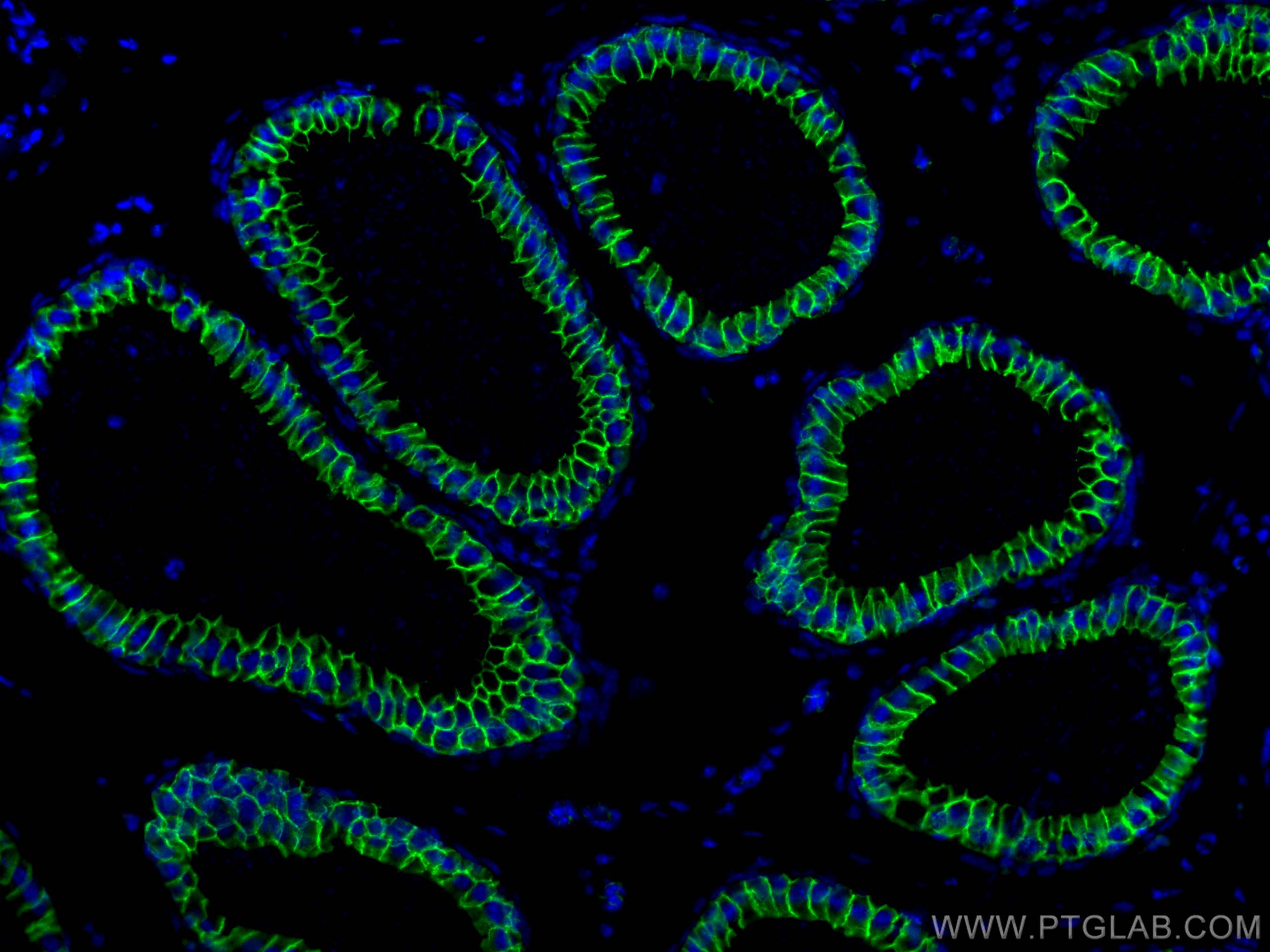 Immunofluorescence (IF) / fluorescent staining of mouse testis tissue using Beta Catenin Polyclonal antibody (51067-2-AP)