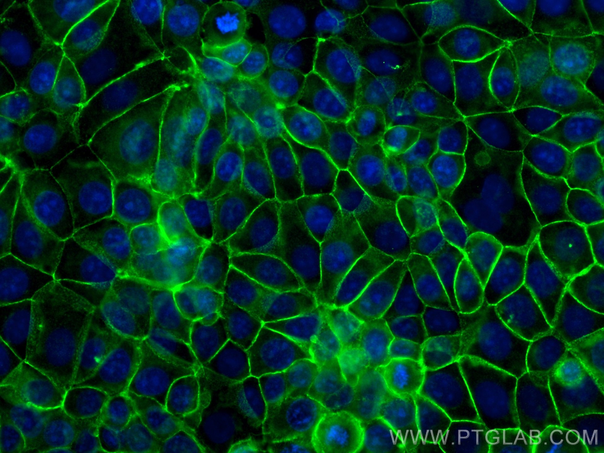 Immunofluorescence (IF) / fluorescent staining of MCF-7 cells using Beta Catenin Polyclonal antibody (51067-2-AP)