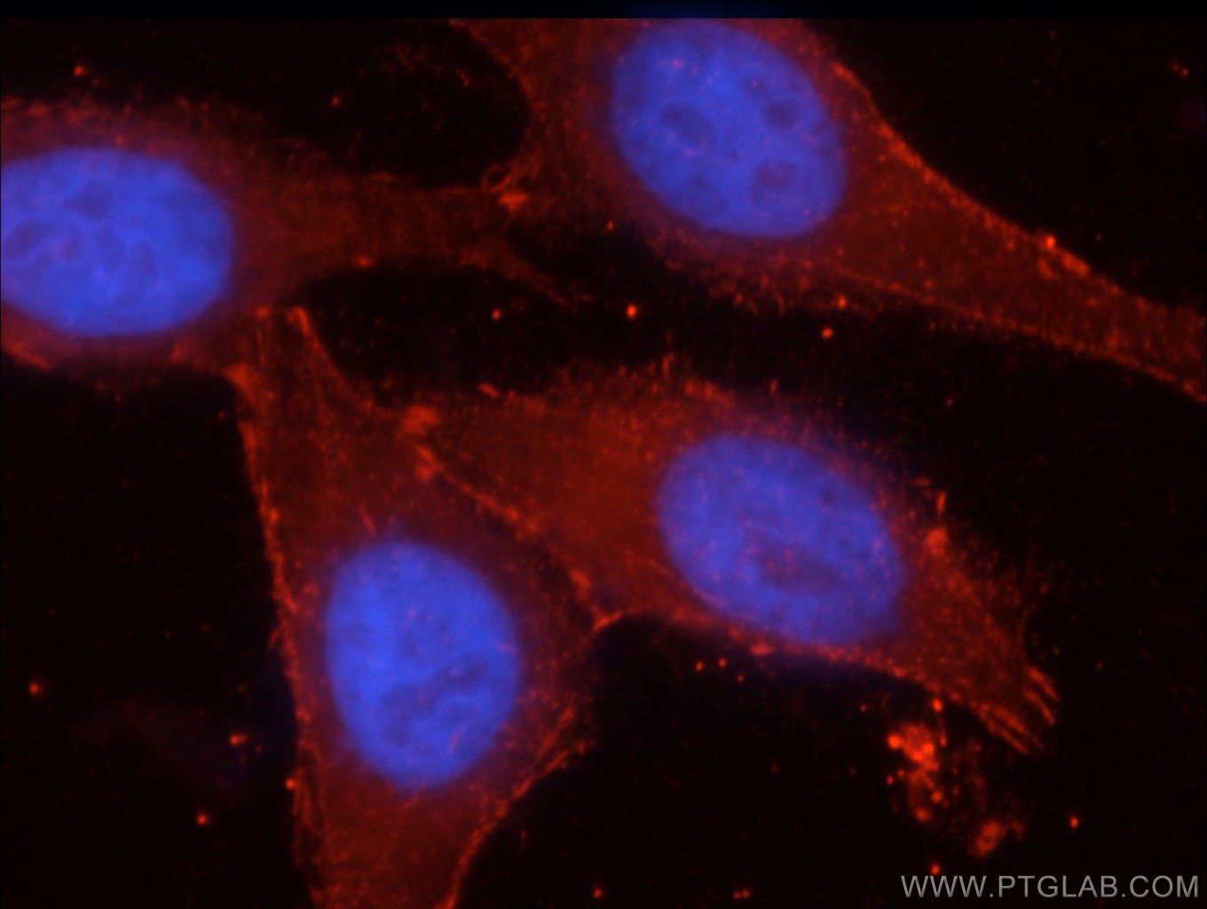 Immunofluorescence (IF) / fluorescent staining of HepG2 cells using Beta Catenin Polyclonal antibody (51067-2-AP)