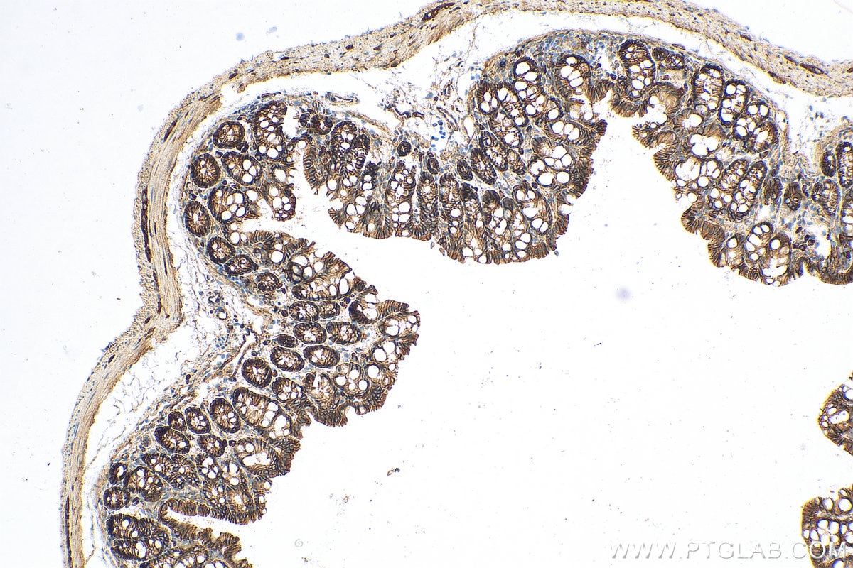 Immunohistochemistry (IHC) staining of mouse colon tissue using Beta Catenin Polyclonal antibody (51067-2-AP)