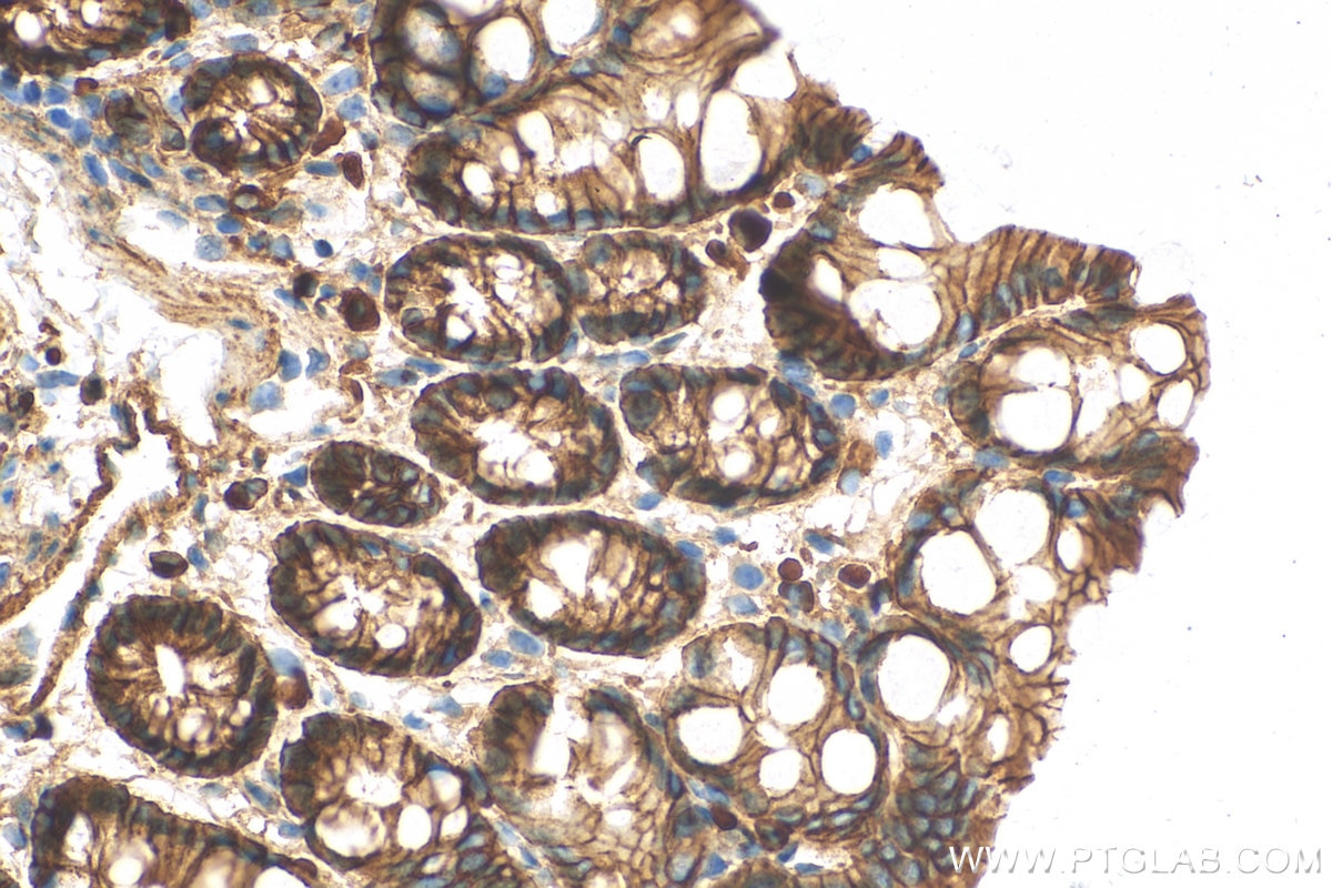 Immunohistochemistry (IHC) staining of mouse colon tissue using Beta Catenin Polyclonal antibody (51067-2-AP)