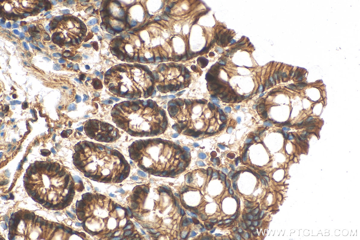 IHC staining of mouse colon using 51067-2-AP