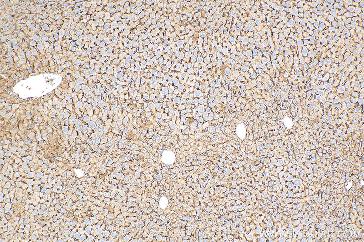Immunohistochemistry (IHC) staining of mouse liver tissue using Beta Catenin Polyclonal antibody (51067-2-AP)