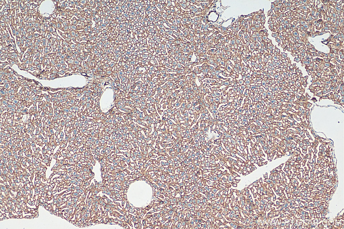 Immunohistochemistry (IHC) staining of mouse liver tissue using Beta Catenin Polyclonal antibody (51067-2-AP)