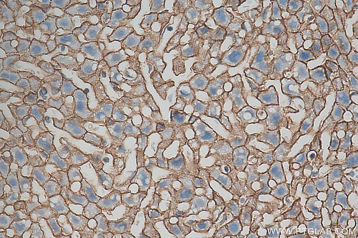 Immunohistochemistry (IHC) staining of mouse liver tissue using Beta Catenin Polyclonal antibody (51067-2-AP)