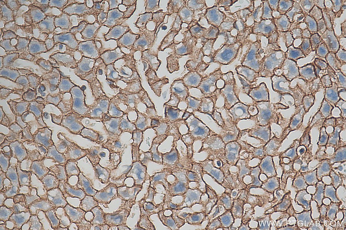 IHC staining of mouse liver using 51067-2-AP