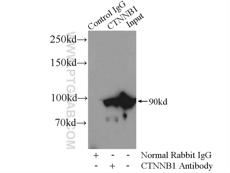 Immunoprecipitation (IP) experiment of mouse liver tissue using Beta Catenin Polyclonal antibody (51067-2-AP)