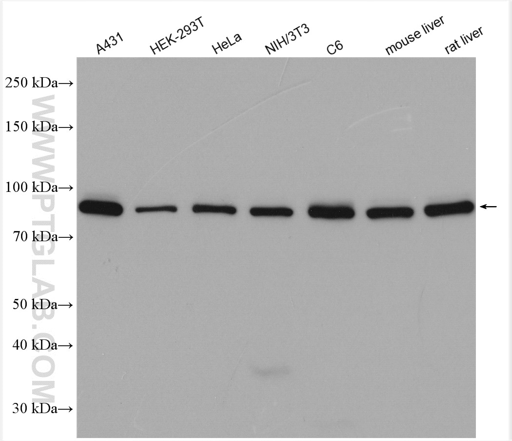 Western Blot (WB) analysis of various lysates using Beta Catenin Polyclonal antibody (51067-2-AP)