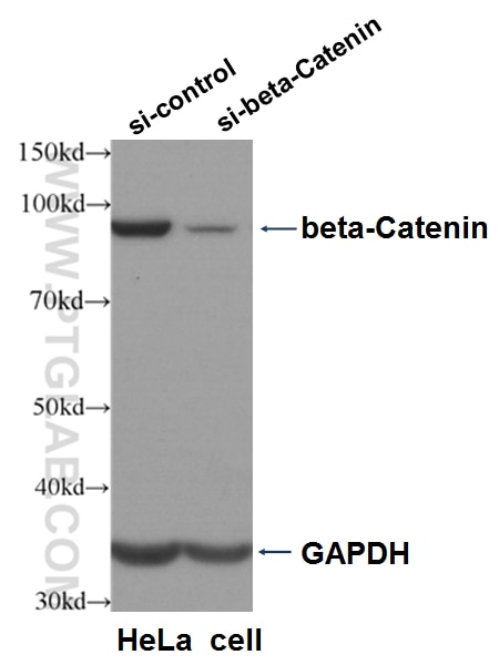 Western Blot (WB) analysis of HeLa cells using Beta Catenin Polyclonal antibody (51067-2-AP)