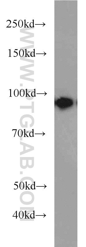 Western Blot (WB) analysis of mouse lung tissue using Beta Catenin Polyclonal antibody (51067-2-AP)