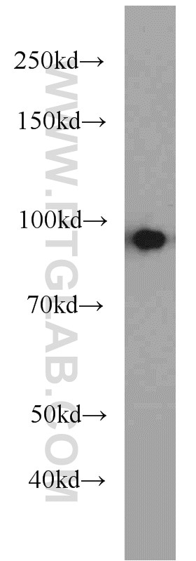 Western Blot (WB) analysis of SH-SY5Y cells using Beta Catenin Polyclonal antibody (51067-2-AP)