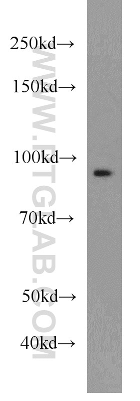 Western Blot (WB) analysis of MCF-7 cells using Beta Catenin Polyclonal antibody (51067-2-AP)