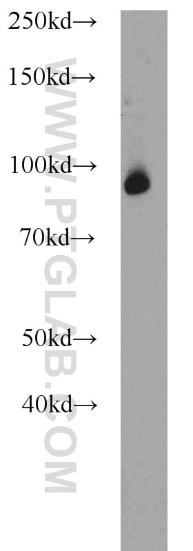 Western Blot (WB) analysis of human placenta tissue using Beta Catenin Polyclonal antibody (51067-2-AP)