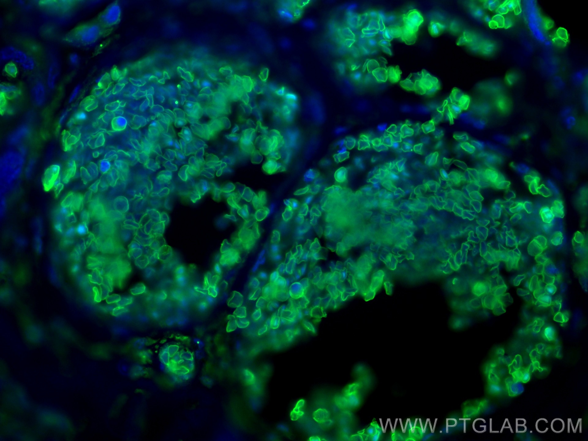 Immunofluorescence (IF) / fluorescent staining of human placenta tissue using band 3/ AE1 Monoclonal antibody (66984-1-Ig)