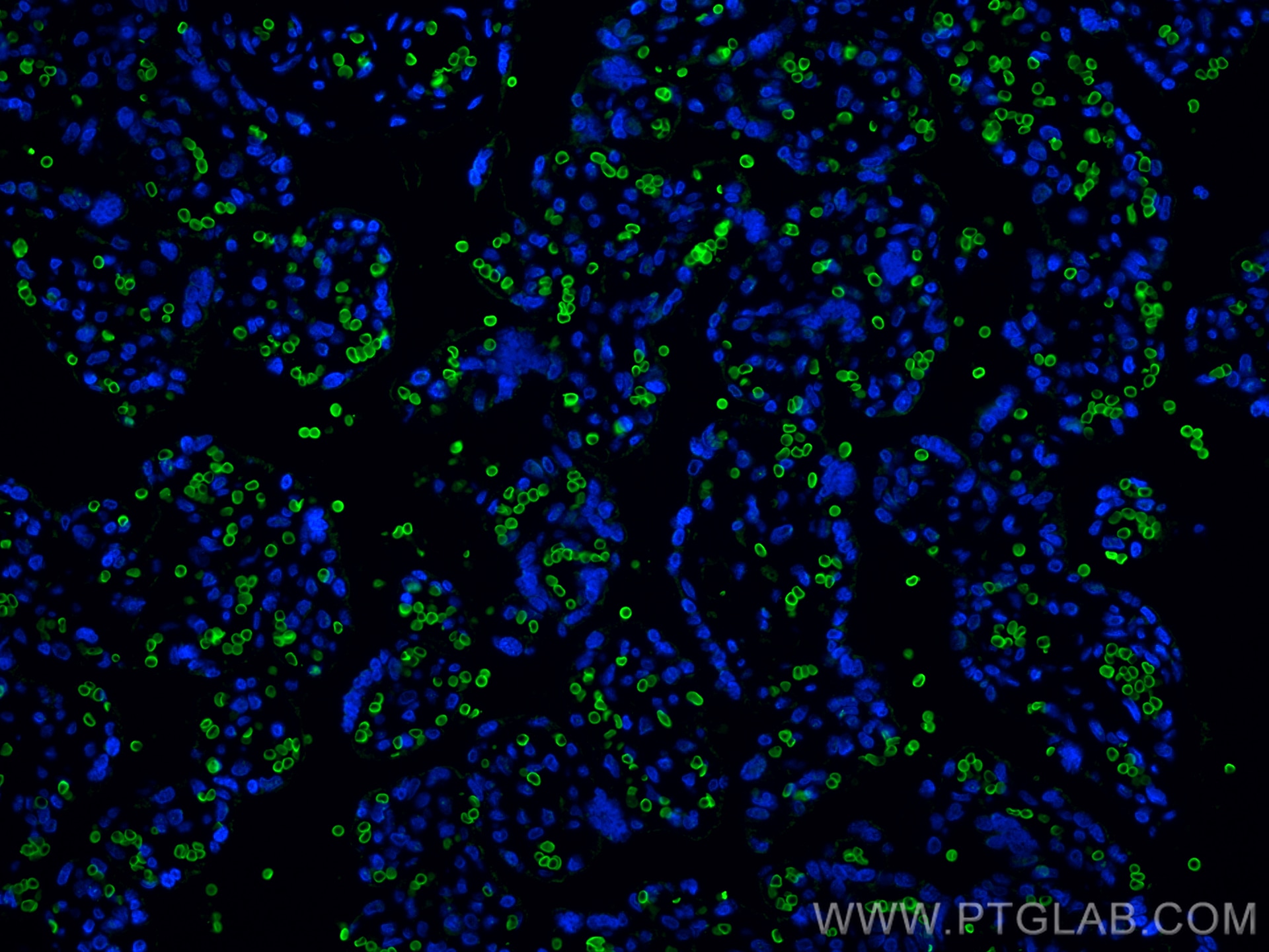 Immunofluorescence (IF) / fluorescent staining of human placenta tissue using Band 3/AE 1 Monoclonal antibody (66984-1-Ig)