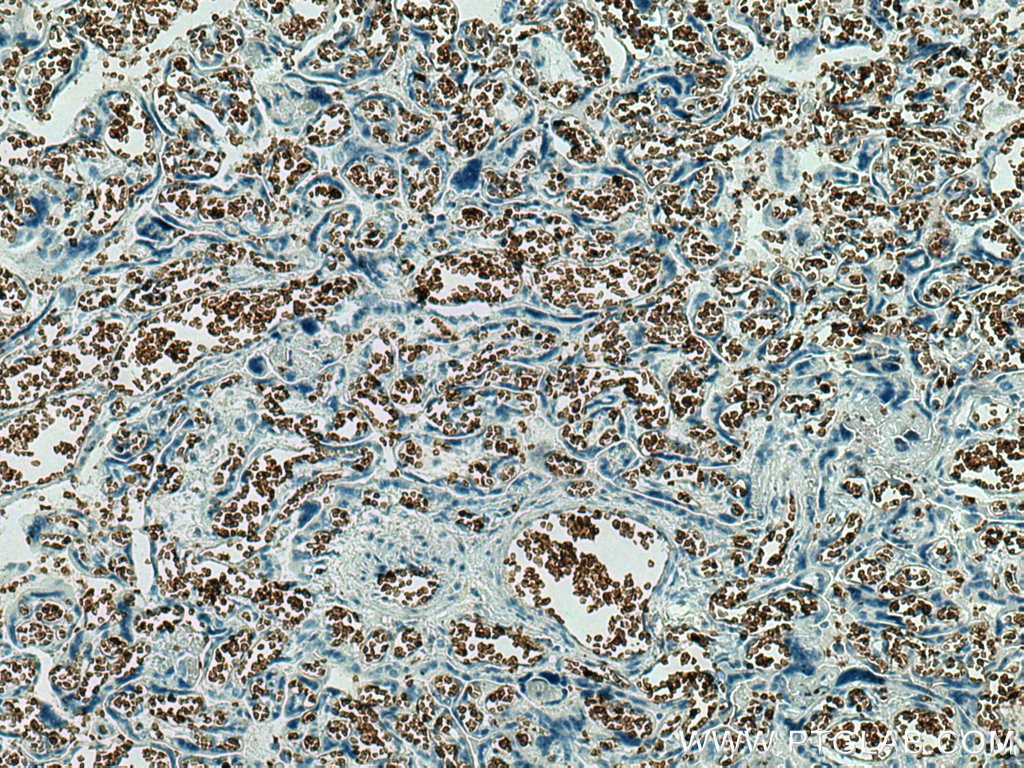 IHC staining of human placenta using 66984-1-Ig