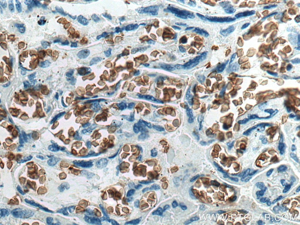 Immunohistochemistry (IHC) staining of human placenta tissue using band 3/ AE1 Monoclonal antibody (66984-1-Ig)