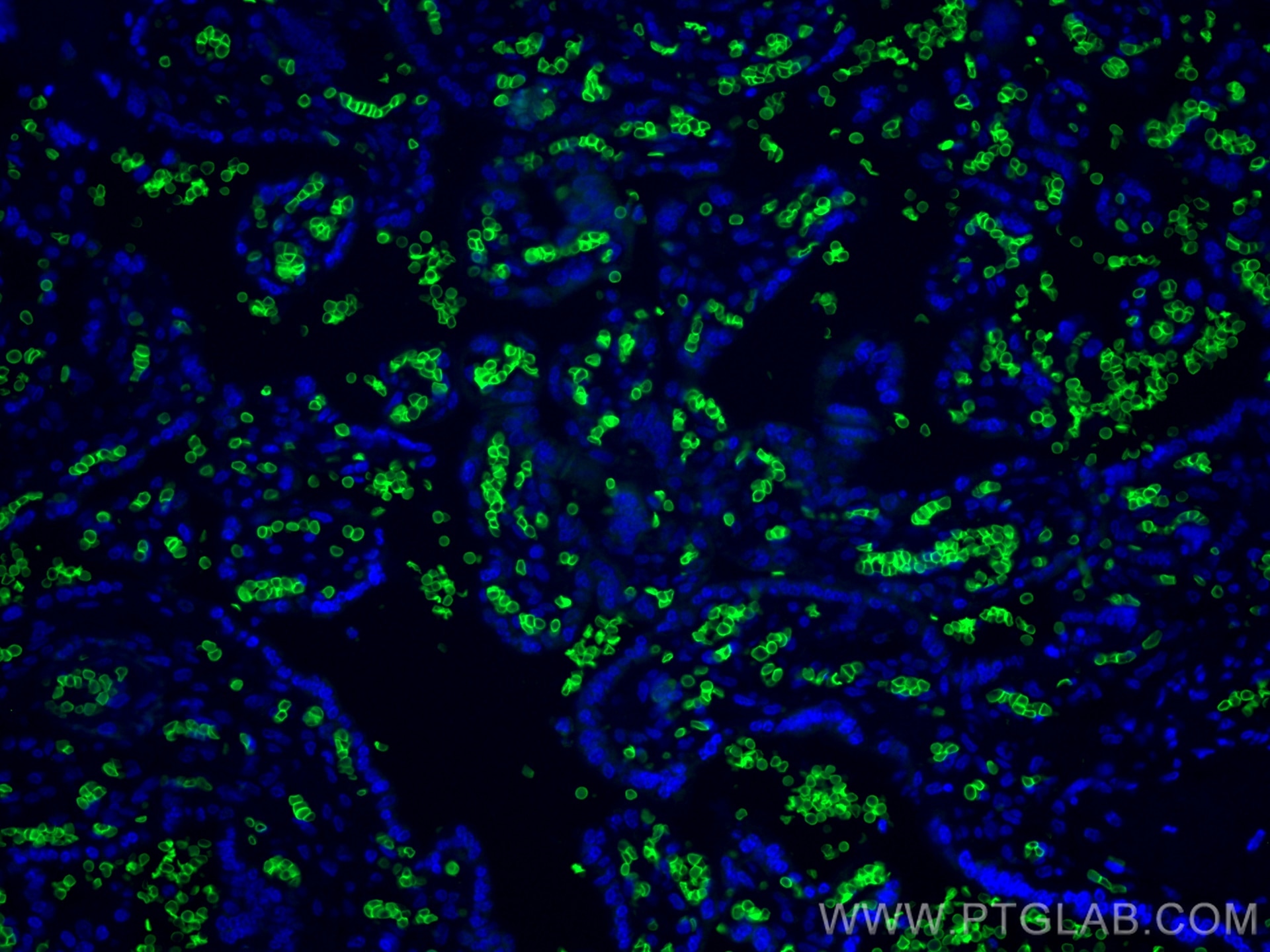 Immunofluorescence (IF) / fluorescent staining of human placenta tissue using CoraLite® Plus 488-conjugated band 3/ AE1 Monoclon (CL488-66984)