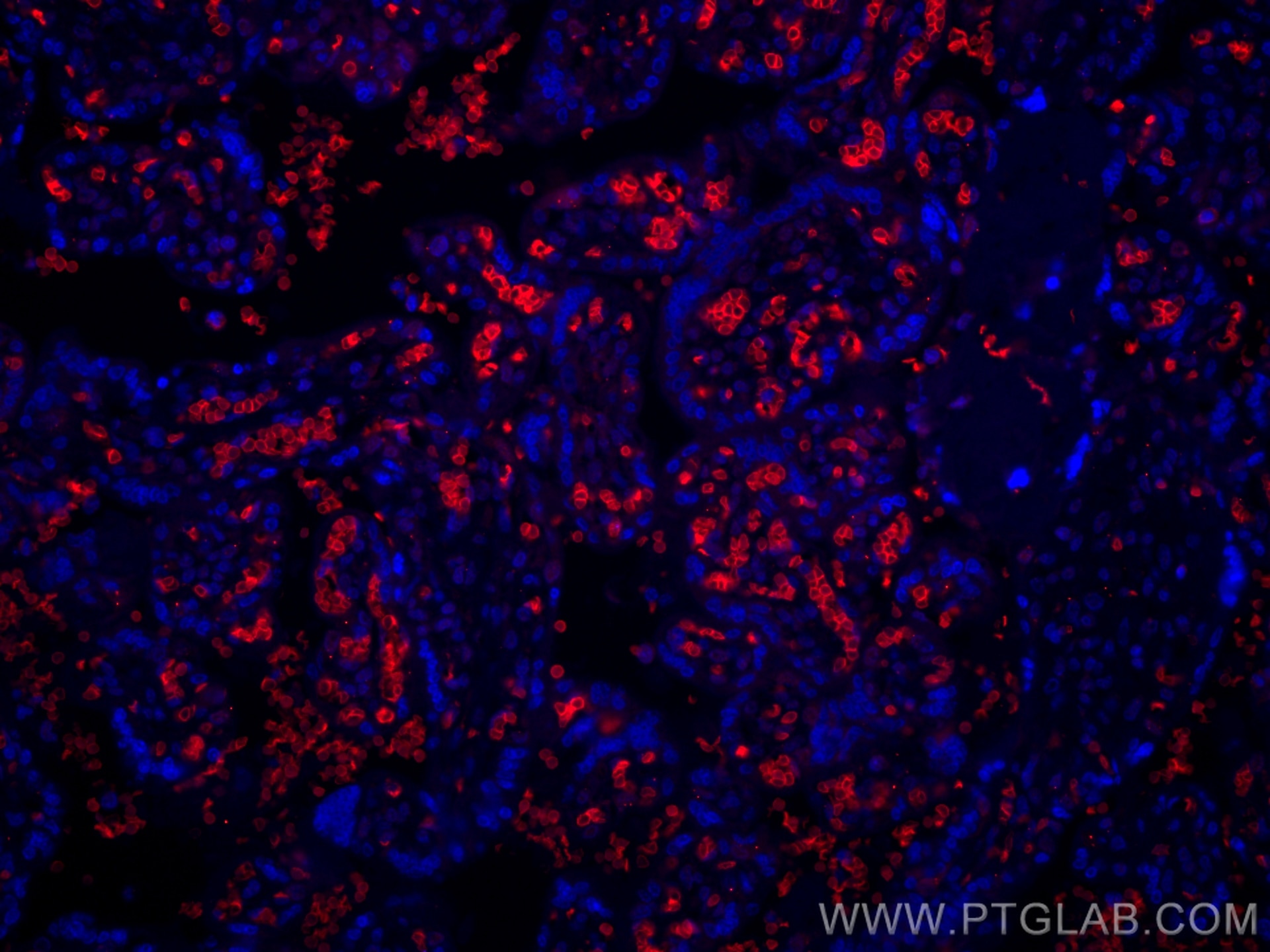 IF Staining of human placenta using CL594-66984
