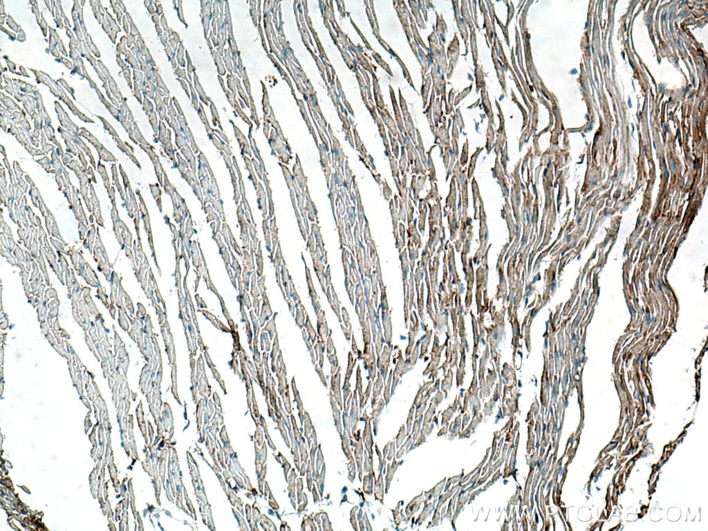 Immunohistochemistry (IHC) staining of mouse heart tissue using Biotin-conjugated Beta Actin Monoclonal antibody (Biotin-60008)