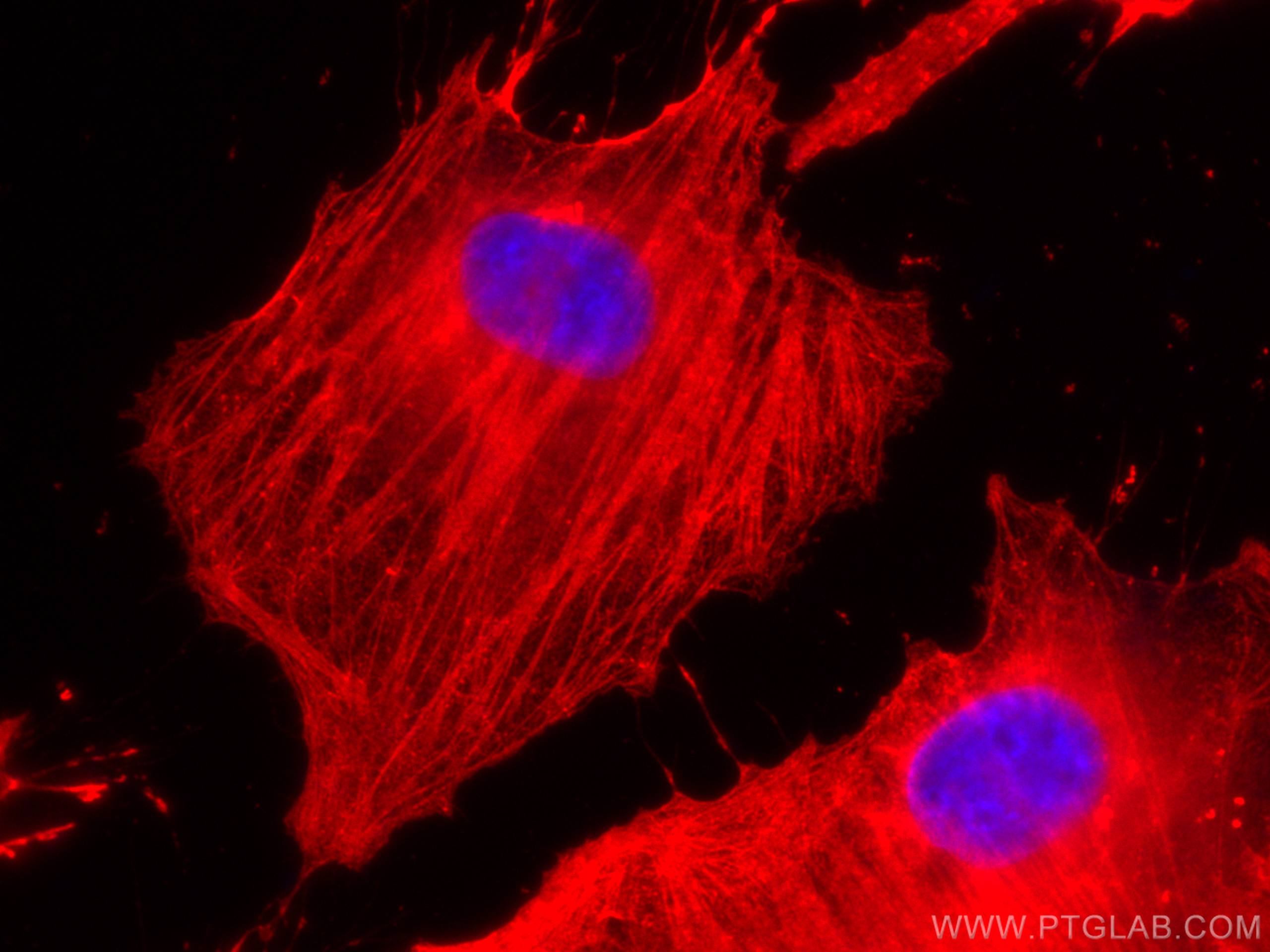 Immunofluorescence (IF) / fluorescent staining of HeLa cells using CoraLite®594-conjugated Beta Actin Monoclonal anti (CL594-60008)