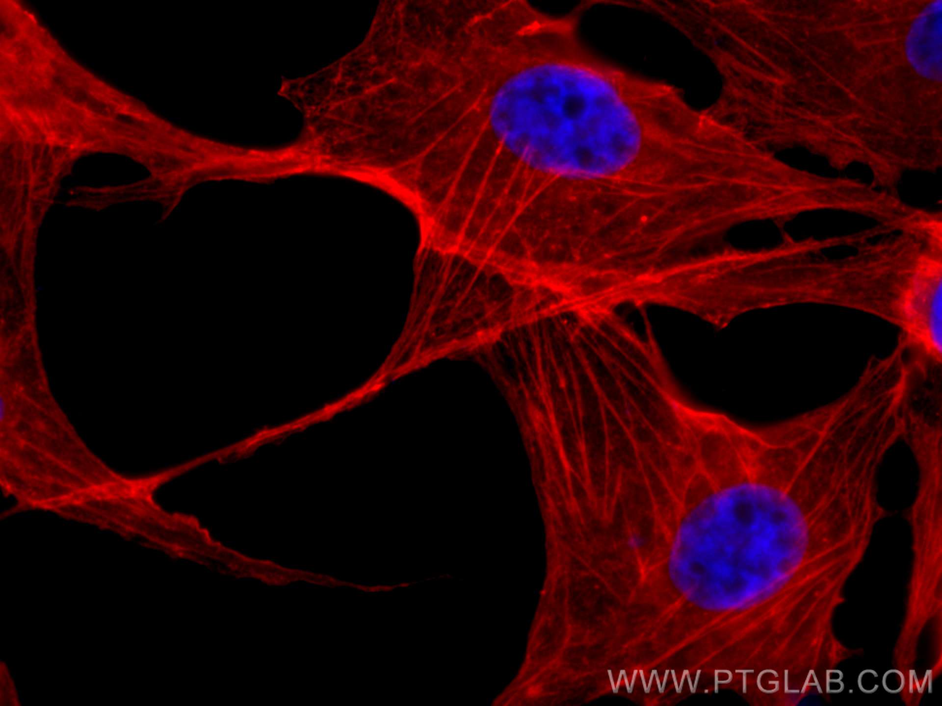 Immunofluorescence (IF) / fluorescent staining of MDCK cells using CoraLite®594-conjugated Beta Actin Monoclonal anti (CL594-60008)