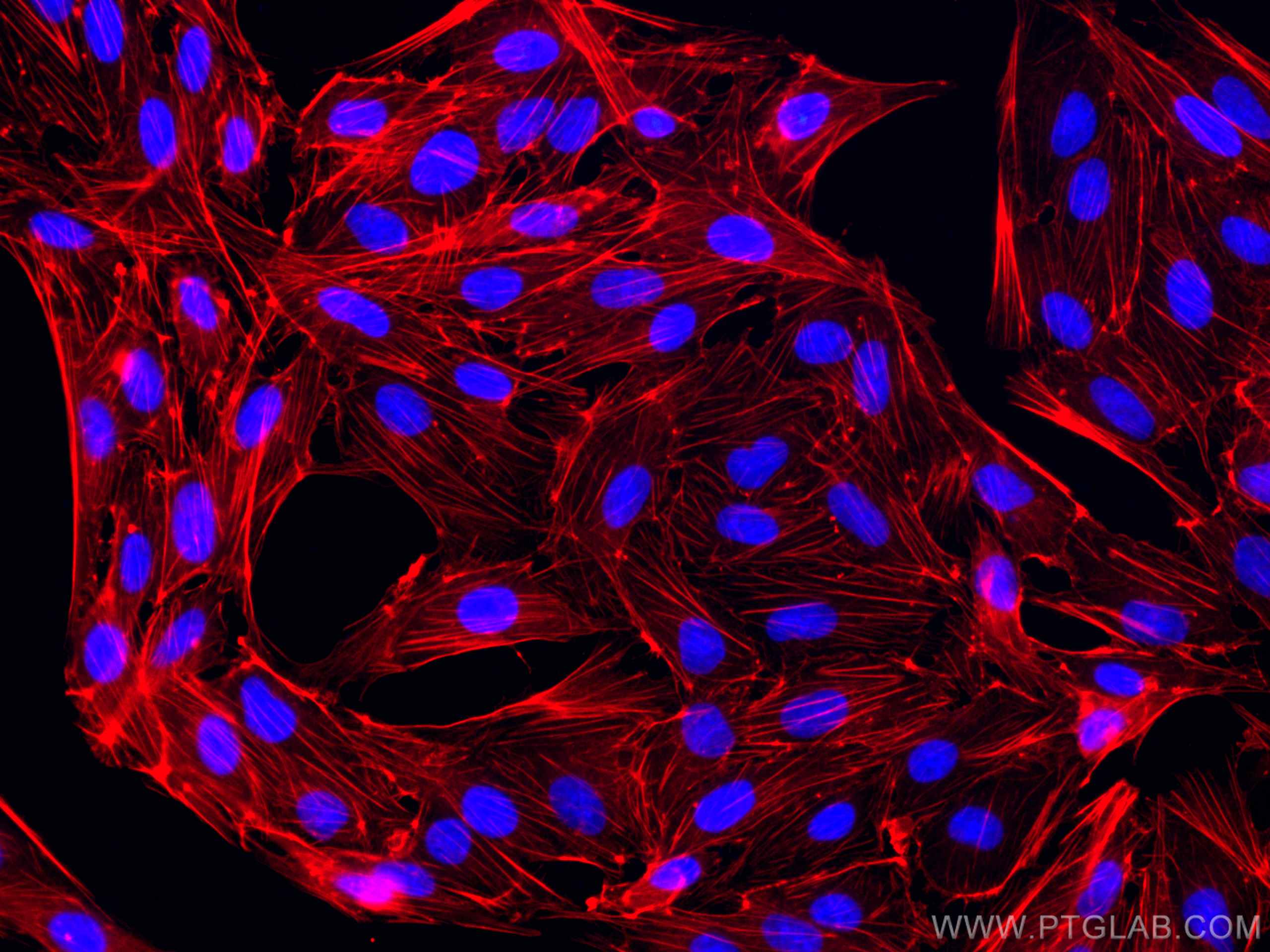 Immunofluorescence (IF) / fluorescent staining of MDCK cells using CoraLite®594-conjugated Beta Actin Monoclonal anti (CL594-66009)