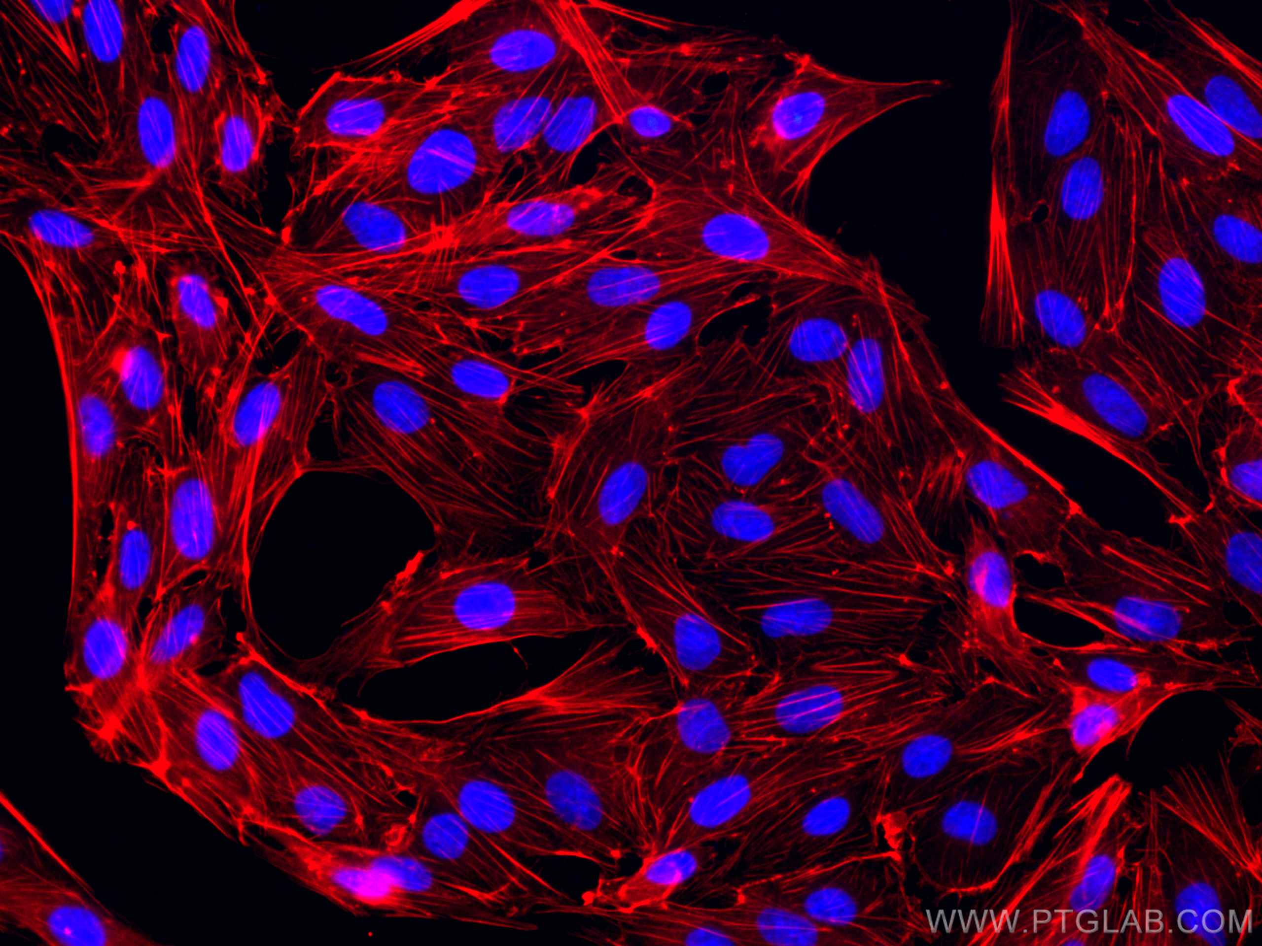 IF Staining of MDCK using CL594-66009