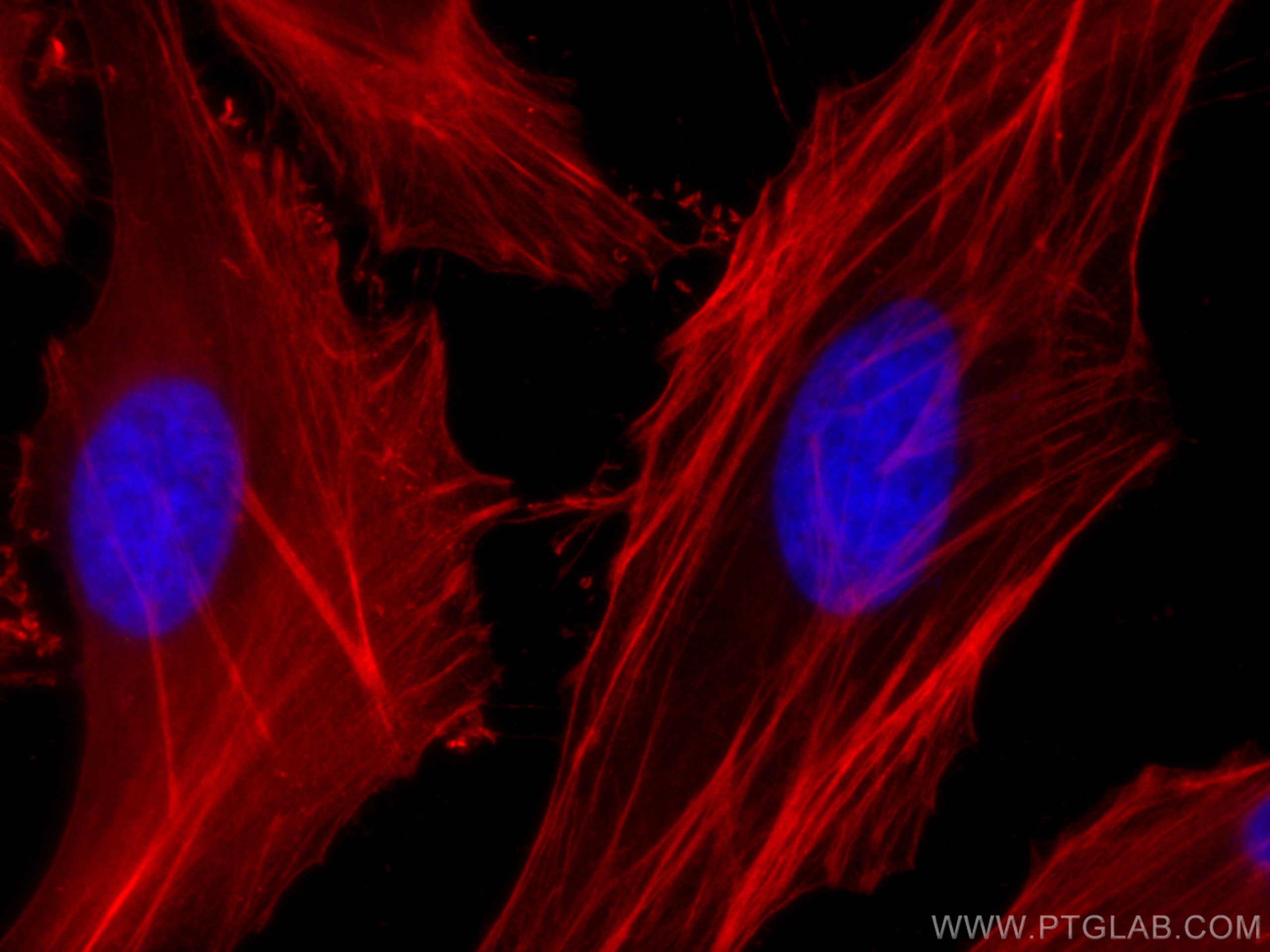 Immunofluorescence (IF) / fluorescent staining of HepG2 cells using CoraLite®594-conjugated Beta Actin Monoclonal anti (CL594-66009)
