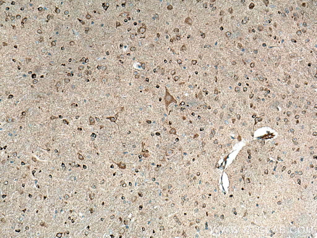 Immunohistochemistry (IHC) staining of mouse brain tissue using APP Polyclonal antibody (27320-1-AP)