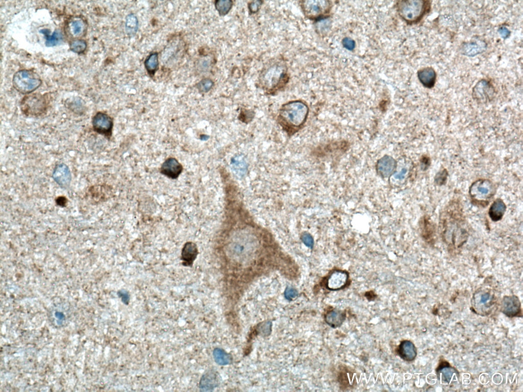 Immunohistochemistry (IHC) staining of mouse brain tissue using APP Polyclonal antibody (27320-1-AP)
