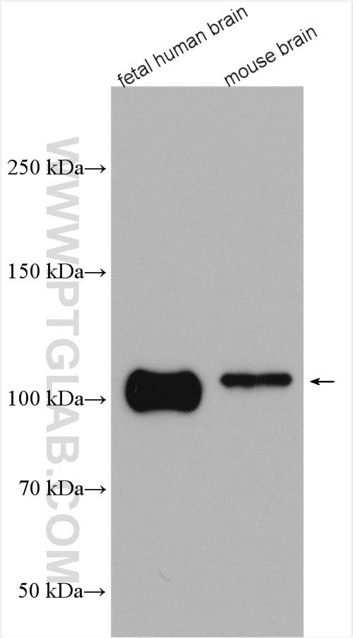 Western Blot (WB) analysis of various lysates using APP Polyclonal antibody (27320-1-AP)