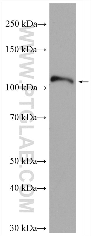 Western Blot (WB) analysis of U-251 cells using APP Polyclonal antibody (27320-1-AP)