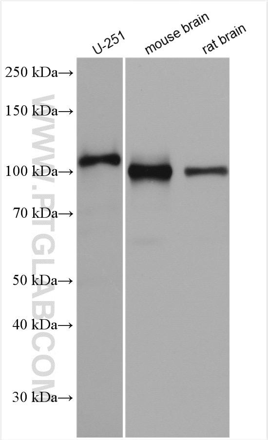 Western Blot (WB) analysis of various lysates using APP Polyclonal antibody (27320-1-AP)