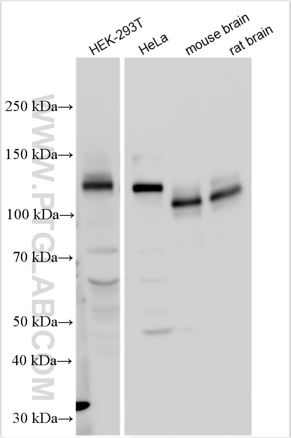 Western Blot (WB) analysis of various lysates using APP Polyclonal antibody (27320-1-AP)