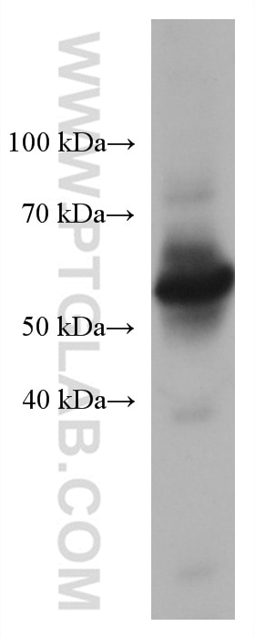 Western Blot (WB) analysis of human peripheral blood platelets using Beta Arrestin 1 Monoclonal antibody (67580-1-Ig)