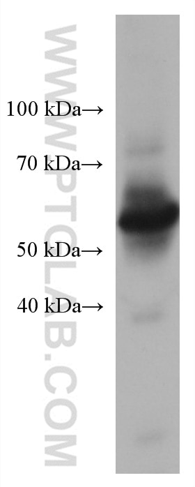 WB analysis of human peripheral blood platelets using 67580-1-Ig