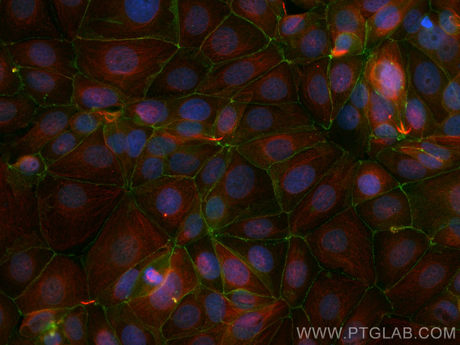 Immunofluorescence (IF) / fluorescent staining of MCF-7 cells using CoraLite® Plus 488-conjugated Beta Catenin Monoclo (CL488-66379)
