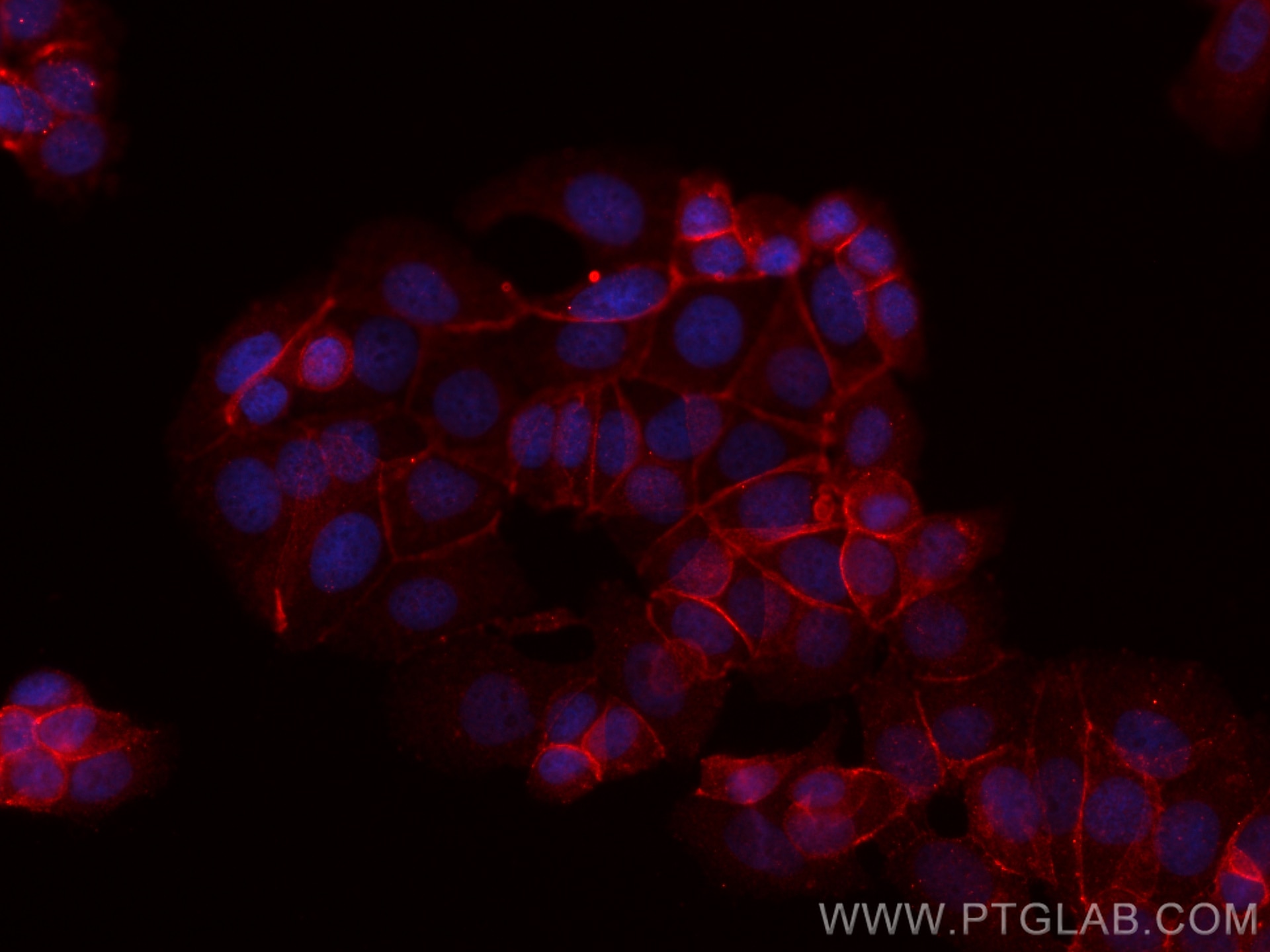 Immunofluorescence (IF) / fluorescent staining of MCF-7 cells using CoraLite®594-conjugated Beta Catenin Monoclonal an (CL594-66379)