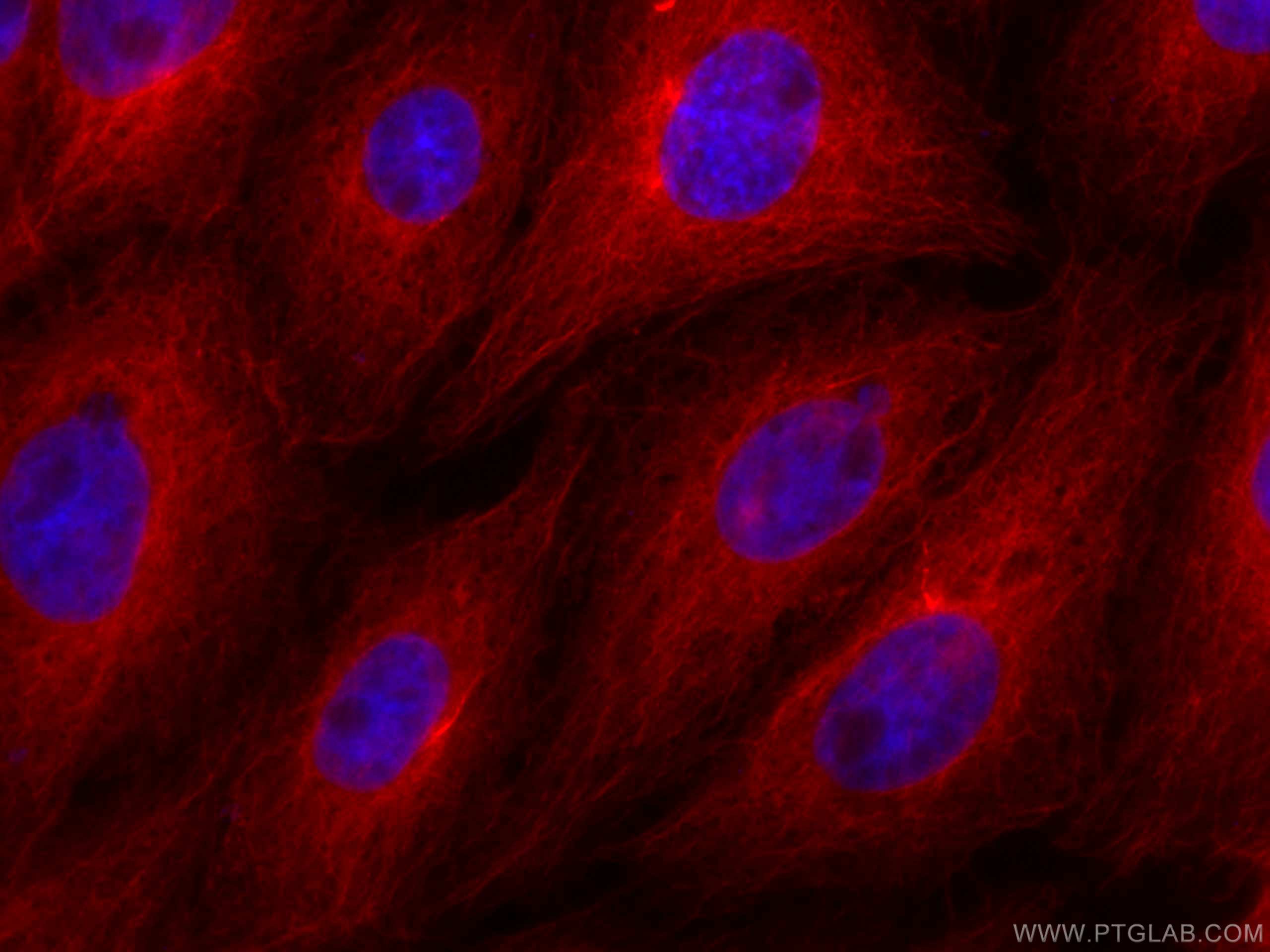 Immunofluorescence (IF) / fluorescent staining of SH-SY5Y cells using CoraLite®594-conjugated Beta Tubulin Monoclonal an (CL594-66240)