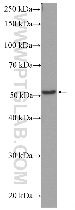 WB analysis of HeLa using HRP-66240