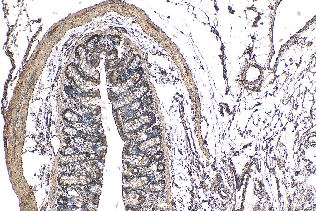 Immunohistochemistry (IHC) staining of rat colon tissue using Beta Actin Recombinant antibody (81115-1-RR)