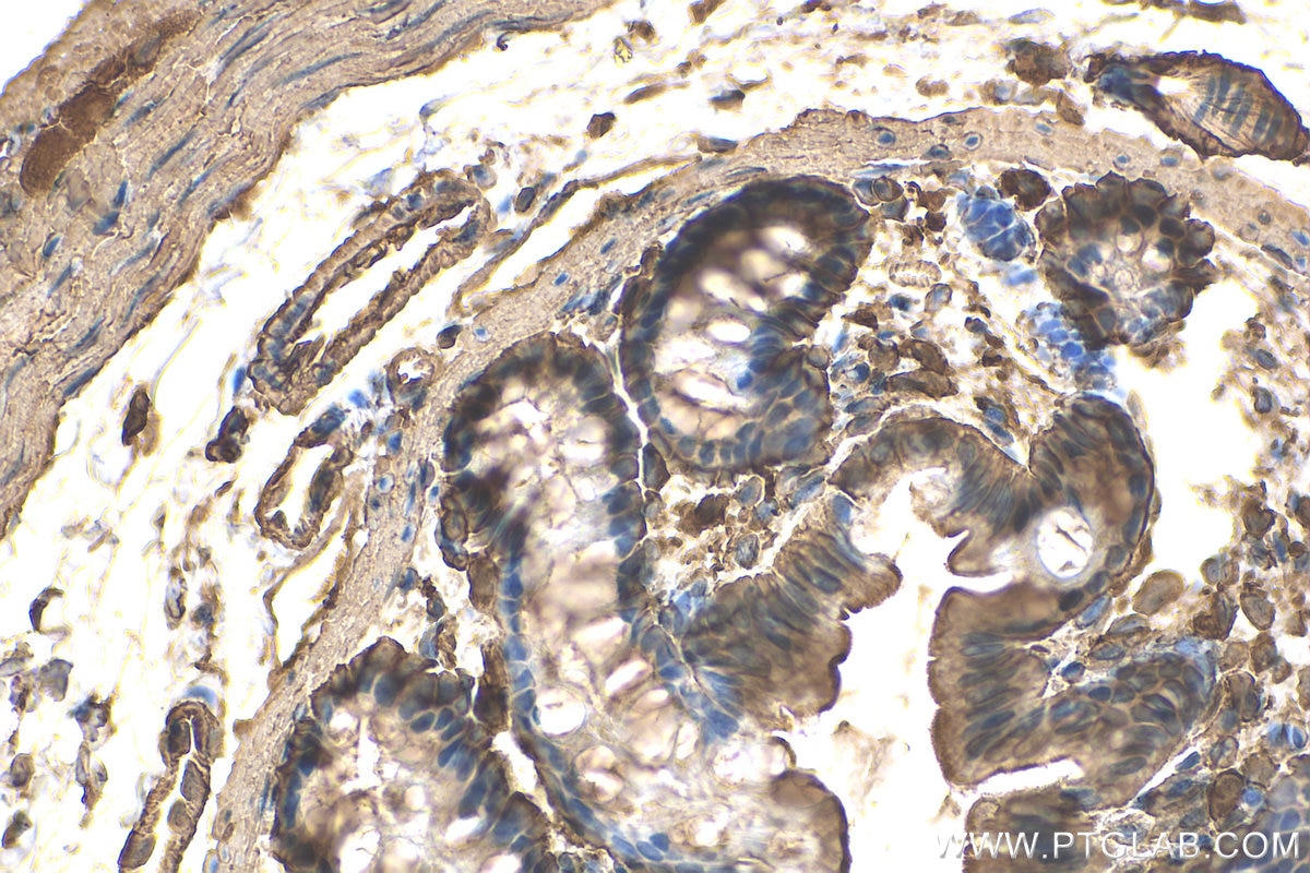 Immunohistochemistry (IHC) staining of rat colon tissue using Beta Actin Recombinant antibody (81115-1-RR)