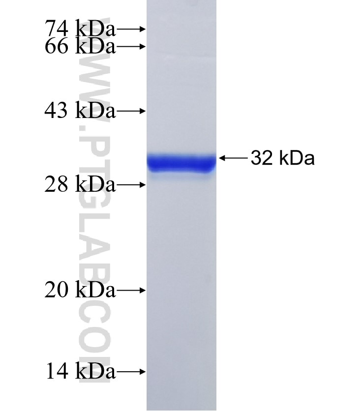 beta actin fusion protein Ag14521 SDS-PAGE