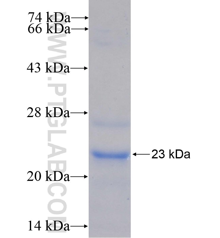 beta actin fusion protein Ag16704 SDS-PAGE