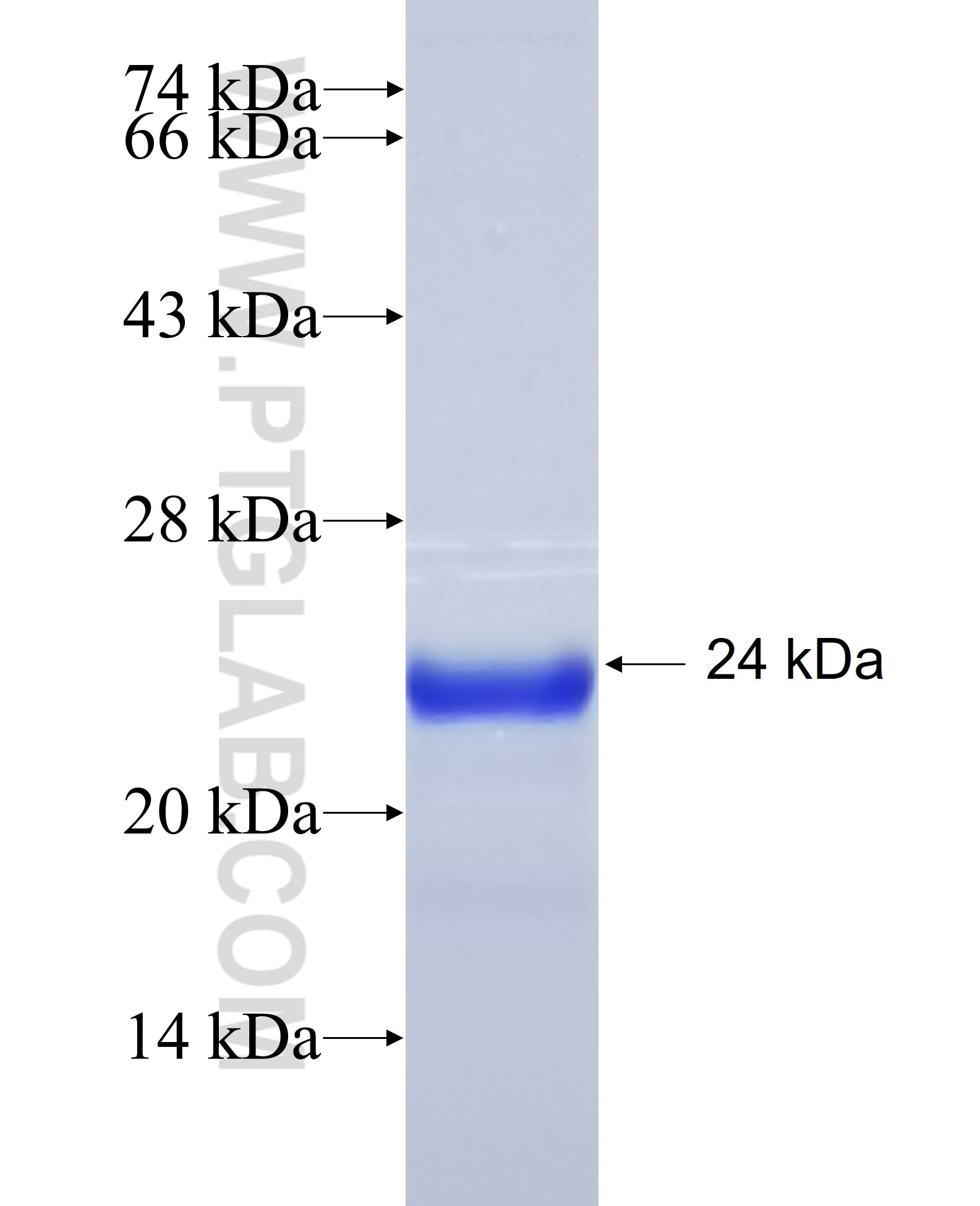 beta actin fusion protein Ag16704 SDS-PAGE