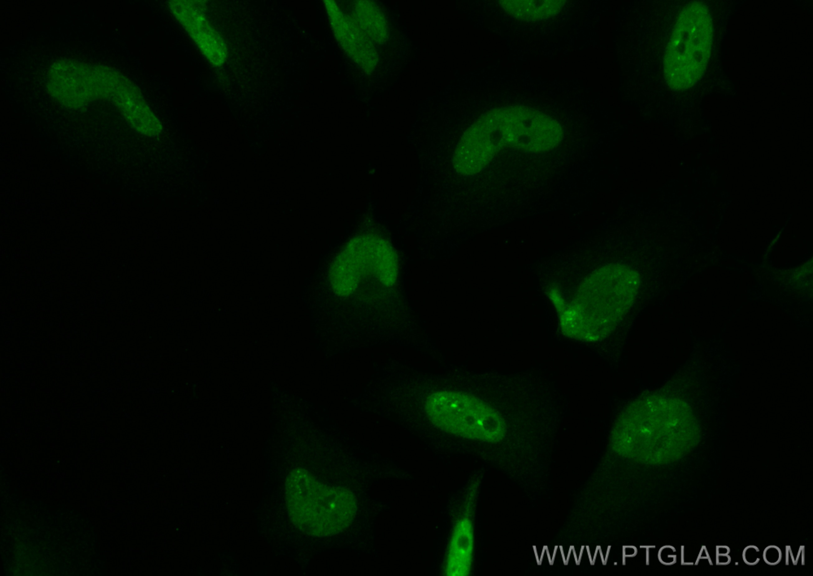 Immunofluorescence (IF) / fluorescent staining of HeLa cells using CoraLite® Plus 488-conjugated c-MYC Recombinant an (CL488-80845)