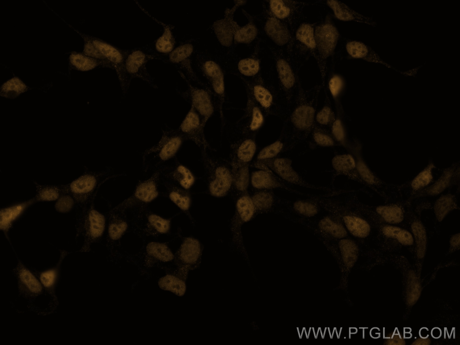 Immunofluorescence (IF) / fluorescent staining of HEK-293 cells using CoraLite®555-conjugated c-MYC Polyclonal antibody (CL555-10828)