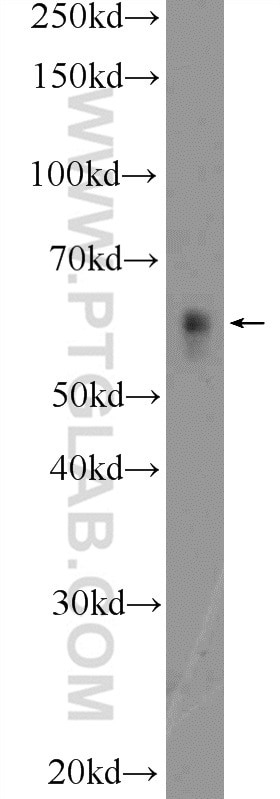 Western Blot (WB) analysis of Jurkat cells using c-SRC Polyclonal antibody (25978-1-AP)