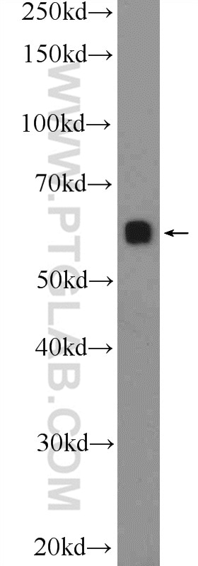 Western Blot (WB) analysis of COLO 320 cells using c-SRC Polyclonal antibody (25978-1-AP)